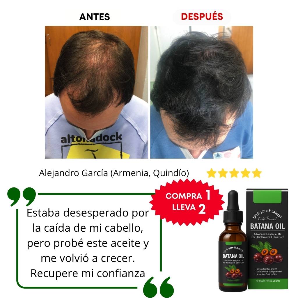 Aceite de batana / El único método para prevenir la caída del cabello